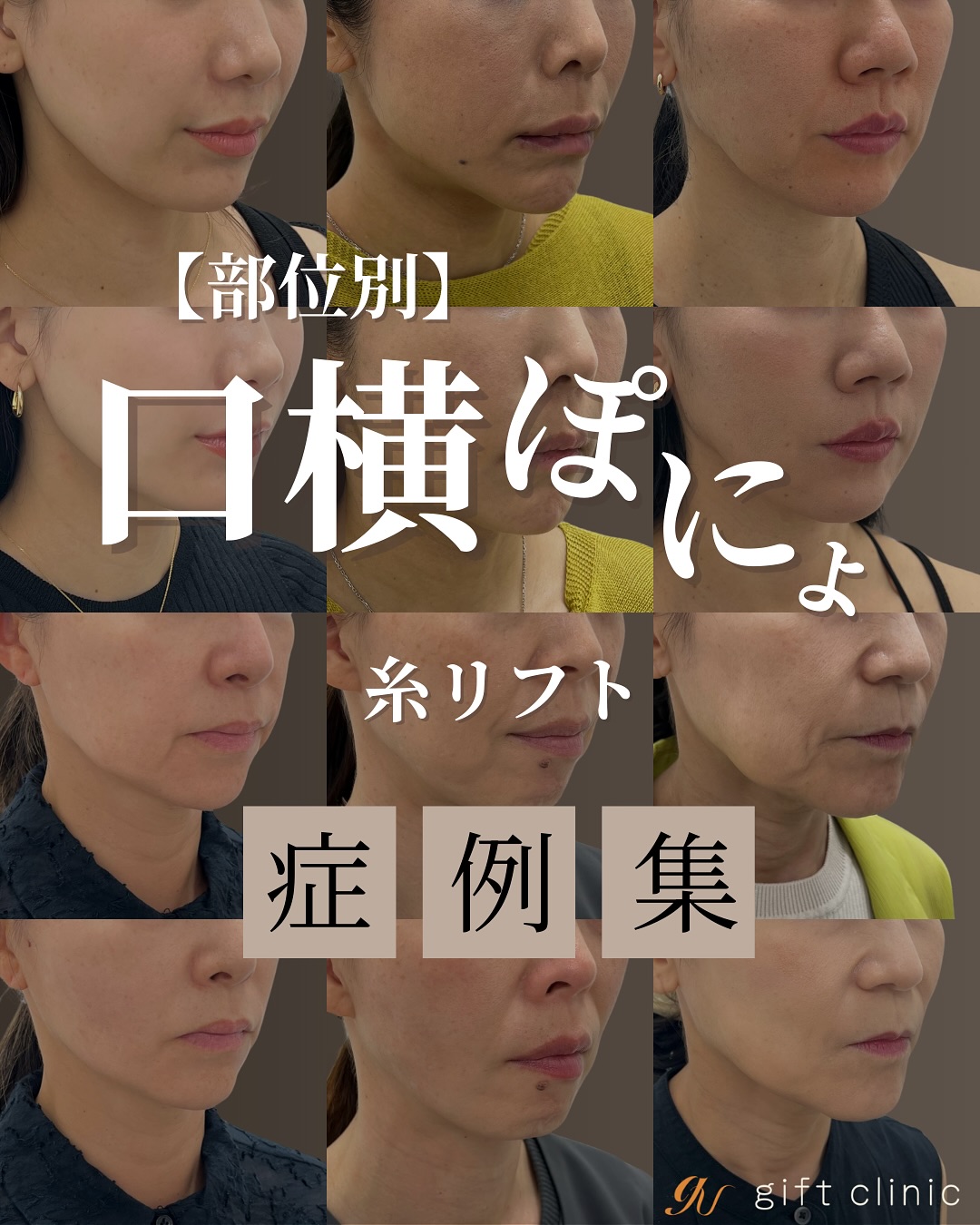 口横ぽにょ症例