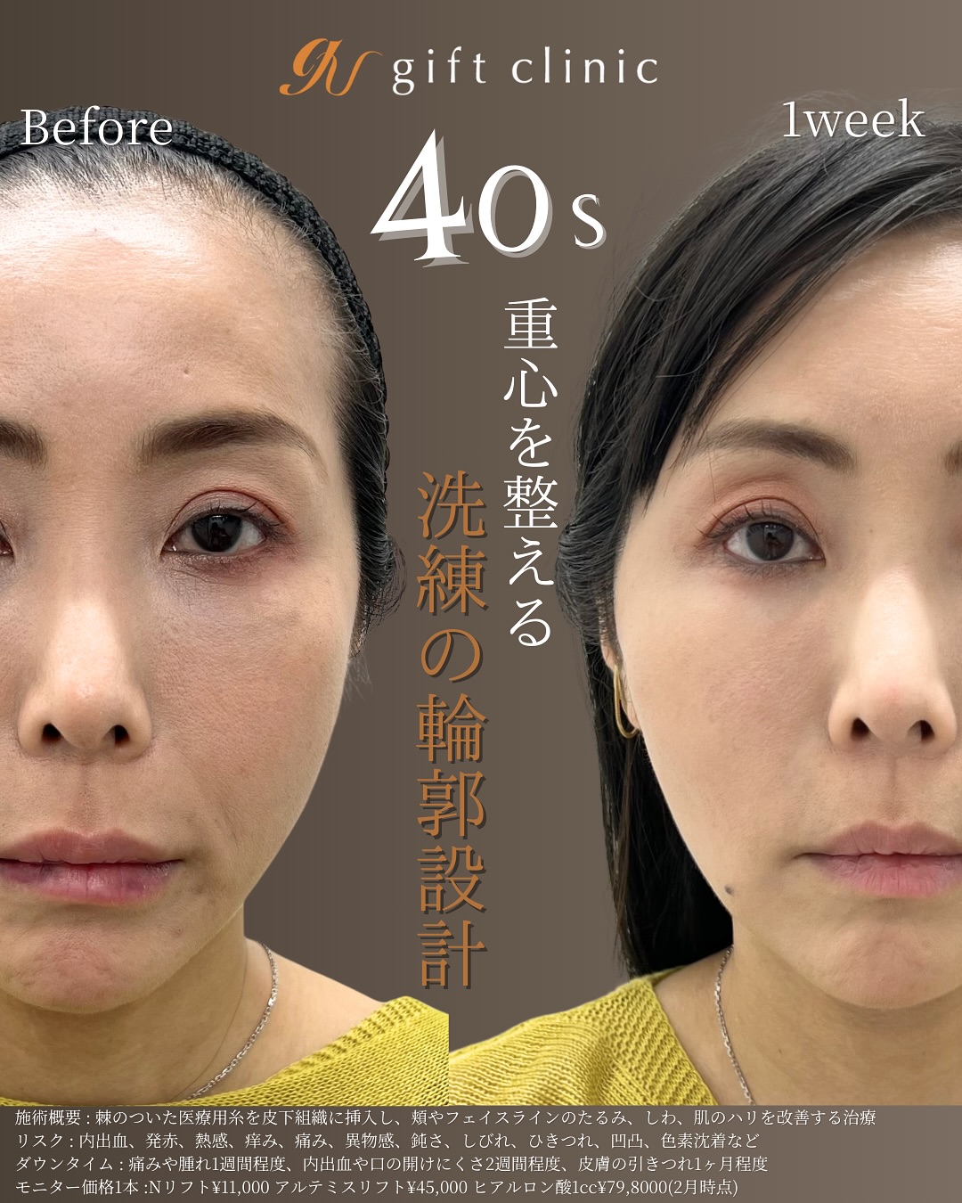 40s 洗練の輪郭設計 Before/After